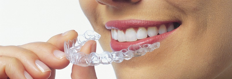 woman holding Invisalign tray in front of her mouth