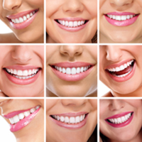 How to Achieve a More Aesthetic Smile: Contouring and Reshaping