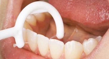 Not a of Flossing? Try These Alternatives. - Dentist in La Mesa, CA